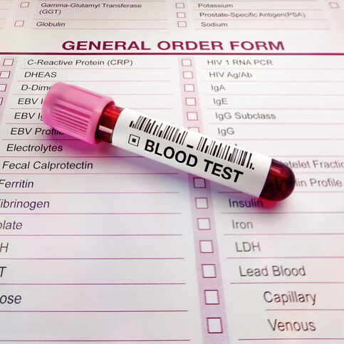 Blood test tube and form with list of analysis tests in medical laboratory Blood testing from a patient on the test request form requested by the doctor for medical review. Blood test tube and form with list of analysis tests in medical laboratory