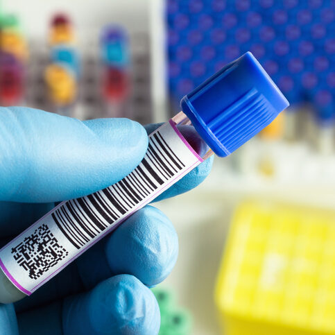 hand holding a tube of blood hand of a technician holding a tube of blood in a laboratory